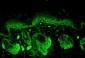 MNSOD / SOD2 Antibody